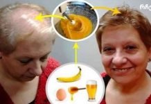 თმის ზრდის რეცეპტი: ექიმებიც კი ჩუმად არიან!