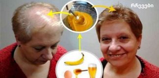 თმის ზრდის რეცეპტი: ექიმებიც კი ჩუმად არიან!