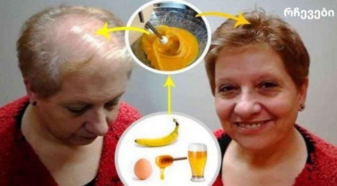 თმის ზრდის რეცეპტი: ექიმებიც კი ჩუმად არიან!