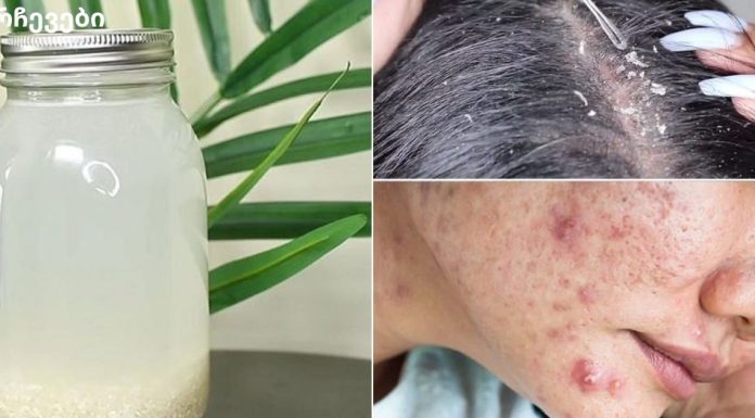 როგორ გამოვიყენოთ ბრინჯის წყალი გრძელი და ჯანსაღი თმისთვის