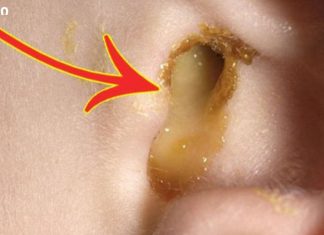 ყურადღება მიაქციეთ ყურის ინფექციას! აი, როგორ შეგიძლიათ განკურნოთ ინფექციები მხოლოდ 1 დღეში!