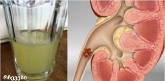 გააუმჯობესეთ თქვენი თირკმელების ჯანმრთელობა ამ სასმელის მხოლოდ ნახევარი ჭიქის დალევით!