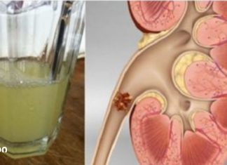 გააუმჯობესეთ თქვენი თირკმელების ჯანმრთელობა ამ სასმელის მხოლოდ ნახევარი ჭიქის დალევით!