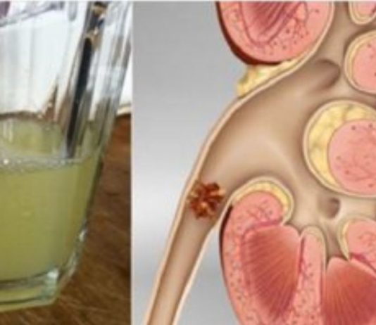 გააუმჯობესეთ თქვენი თირკმელების ჯანმრთელობა ამ სასმელის მხოლოდ ნახევარი ჭიქის დალევით!