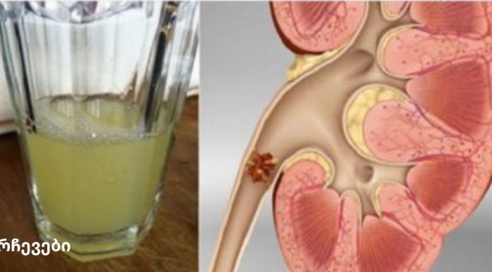 გააუმჯობესეთ თქვენი თირკმელების ჯანმრთელობა ამ სასმელის მხოლოდ ნახევარი ჭიქის დალევით!