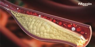 ამ წვენის მხოლოდ 1 ჭიქა დაგეხმარებათ არტერიების გაწმენდაში!