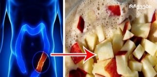 გაასუფთავეთ თქვენი მსხვილი ნაწლავი დაგროვილი ტოქსინებისგან მხოლოდ 4 ინგრედიენტით!