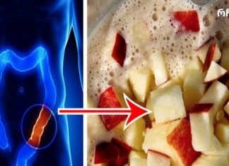 გაასუფთავეთ თქვენი მსხვილი ნაწლავი დაგროვილი ტოქსინებისგან მხოლოდ 4 ინგრედიენტით!