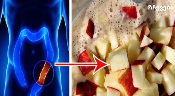 გაასუფთავეთ თქვენი მსხვილი ნაწლავი დაგროვილი ტოქსინებისგან მხოლოდ 4 ინგრედიენტით!