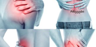 ეს რეცეპტი გასაოცარია! სულ რაღაც ერთ დღეში მოგიხსნით სახსრების ტკივილს!