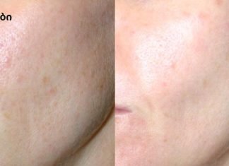 აღარ იქნება ნაოჭები და სახის კანი – და მხოლოდ 2 ინგრედიენტი!