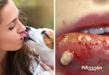 აი რატომ არასოდეს უნდა მისცეთ თქვენს ძაღლს უფლება აგლოკოთ.