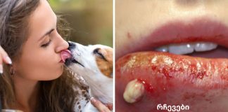 აი რატომ არასოდეს უნდა მისცეთ თქვენს ძაღლს უფლება აგლოკოთ.