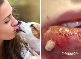 აი რატომ არასოდეს უნდა მისცეთ თქვენს ძაღლს უფლება აგლოკოთ.