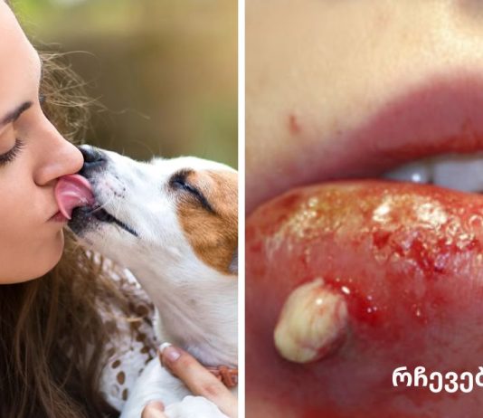 აი რატომ არასოდეს უნდა მისცეთ თქვენს ძაღლს უფლება აგლოკოთ.