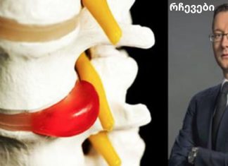 მალათაშუა თიაქრის მკურნალობა წამლებისა და ოპერაციის გარეშე: ზურგის ვარჯიშები პრაქტიკოსისგან