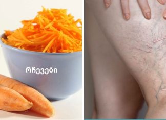 როგორ კურნავდა ჩემი მეზობელი ბებია ვენების ვარიკოზს სტაფილოთი