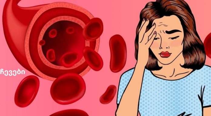 დაბალი ჰემოგლობინი ძალიან საშიში მოვლენაა. მაგრამ ანემიის განკურნება შესაძლებელია და წამლების გარეშე!