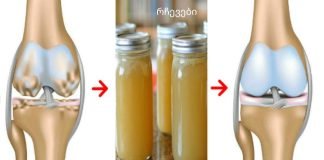 როგორ აღვადგინოთ ძვლები და მყესები სულ რაღაც 7 დღეში?