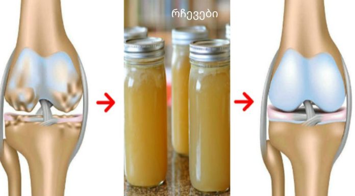 როგორ აღვადგინოთ ძვლები და მყესები სულ რაღაც 7 დღეში?