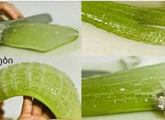 შეწყვიტე ძვირადღირებული მედიკამენტების შეძენა: ალოე ვერას უნიკალური სამკურნალო სარგებელი