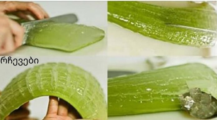 შეწყვიტე ძვირადღირებული მედიკამენტების შეძენა: ალოე ვერას უნიკალური სამკურნალო სარგებელი