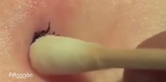 როგორ მოვიშოროთ ტკიპა საკუთარ სახლში: მეთოდი, რომელმაც ასობით ადამიანი გადაარჩინა!