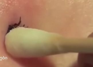 როგორ მოვიშოროთ ტკიპა საკუთარ სახლში: მეთოდი, რომელმაც ასობით ადამიანი გადაარჩინა!