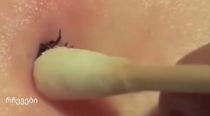 როგორ მოვიშოროთ ტკიპა საკუთარ სახლში: მეთოდი, რომელმაც ასობით ადამიანი გადაარჩინა!