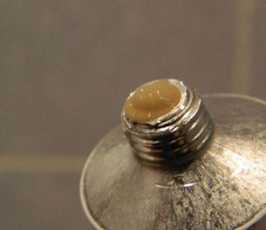 ყველასთვის დავიწყებული ვიშნევსკის მალამო ყოვლისშემძლე წამალია! ეს დაგეხმარებათ ამ დაავადებების წინააღმდეგ ბრძოლაში.