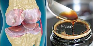 სტატია,რომელიც აუცილებლად წასაკითხია,რადგან ოჯახის ყველა წევრს გამოადგება.ეს საშუალება ამაგრებს სახსრებსა და ძვლებს ბუნებრივი ინგრედიენტებისგან