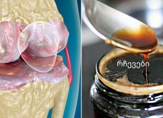 სტატია,რომელიც აუცილებლად წასაკითხია,რადგან ოჯახის ყველა წევრს გამოადგება.ეს საშუალება ამაგრებს სახსრებსა და ძვლებს ბუნებრივი ინგრედიენტებისგან