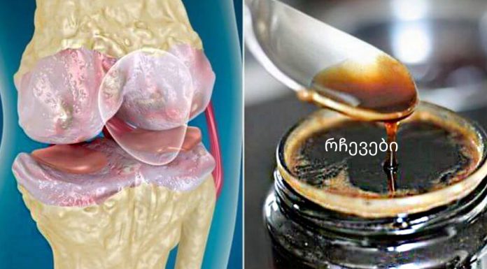 სტატია,რომელიც აუცილებლად წასაკითხია,რადგან ოჯახის ყველა წევრს გამოადგება.ეს საშუალება ამაგრებს სახსრებსა და ძვლებს ბუნებრივი ინგრედიენტებისგან