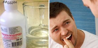 თუ გინდათ რომ პირის ღრუ ჯანმრთელი გქონდეთ ეს აუცილებლად გასათვალისწინებელია.პაროდონტის დაავადების ტოპ 5 საშინაო საშუალება.