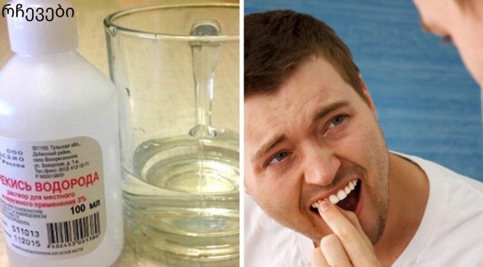 თუ გინდათ რომ პირის ღრუ ჯანმრთელი გქონდეთ ეს აუცილებლად გასათვალისწინებელია.პაროდონტის დაავადების ტოპ 5 საშინაო საშუალება.