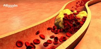 რაც ეს გავიგეთ მას მერე ჩვენ ყველანი ჯანმრთელები ვართ! რატომ აქვთ ალკოჰოლიკებს „სუფთა“ სისხლძარღვები?