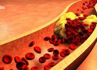 რაც ეს გავიგეთ მას მერე ჩვენ ყველანი ჯანმრთელები ვართ! რატომ აქვთ ალკოჰოლიკებს „სუფთა“ სისხლძარღვები?