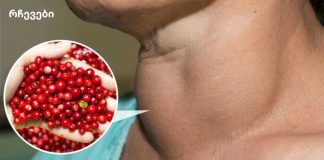 მცენარეული სამკურნალო რჩევები: ფარისებრი ჯირკვლის დაავადების უსაფრთხო რეცეპტები