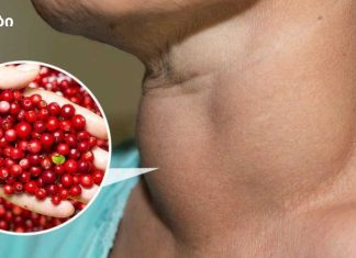 მცენარეული სამკურნალო რჩევები: ფარისებრი ჯირკვლის დაავადების უსაფრთხო რეცეპტები