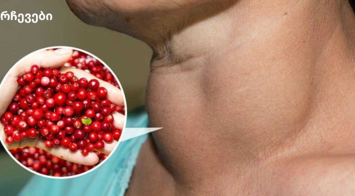 მცენარეული სამკურნალო რჩევები: ფარისებრი ჯირკვლის დაავადების უსაფრთხო რეცეპტები