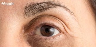 მოიშორეთ ჩაშავებული უპეები სისხლჩაქცევებისგან და შეშუპებისგან.