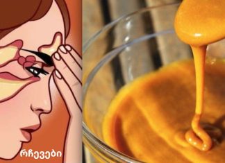 ლორწოს ძალიან ძლიერი საშუალება, ის მოგიხსნით ცხვირიდან გამონადენს, სინუსიტს და ხველას