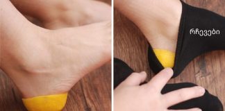 წინდაში ლიმონის ქერქი ჩაიდო.. როცა გავიგე, რატომ გააკეთა ეს,თვალებს არ დავუჯერე.