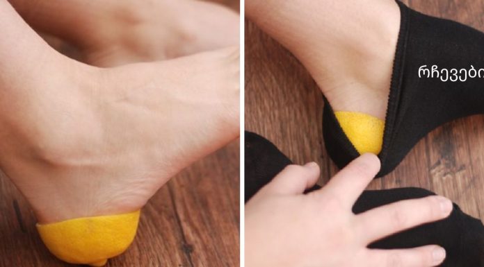 წინდაში ლიმონის ქერქი ჩაიდო.. როცა გავიგე, რატომ გააკეთა ეს,თვალებს არ დავუჯერე.