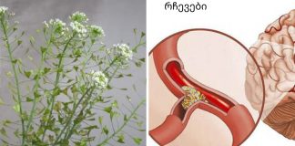 გაქვთ მაღალი წნევა და ხმაური თავში? ჩვენ აღვადგენთ სისხლძარღვებს ელასტიურობას აბების გარეშე