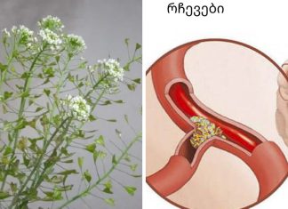 გაქვთ მაღალი წნევა და ხმაური  თავში? ჩვენ აღვადგენთ  სისხლძარღვებს ელასტიურობას აბების გარეშე