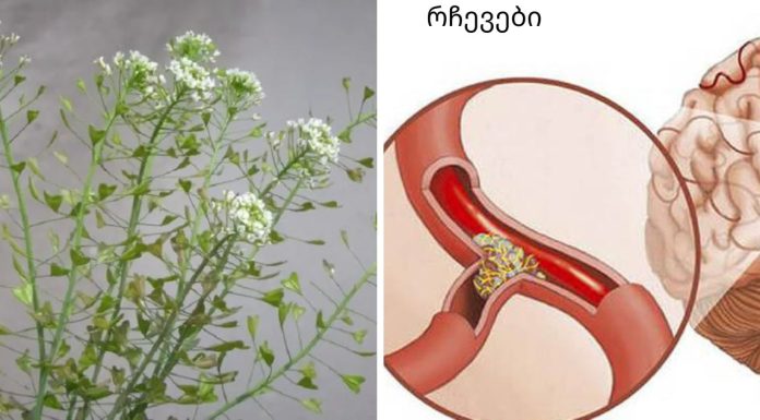 გაქვთ მაღალი წნევა და ხმაური თავში? ჩვენ აღვადგენთ სისხლძარღვებს ელასტიურობას აბების გარეშე