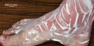 იცოდით, რომ ამ შესანიშნავ საშუალებას შეუძლია შეაჩეროს ძვლებისა და სახსრების პრობლემები?