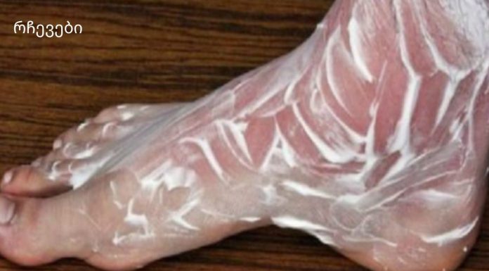 იცოდით, რომ ამ შესანიშნავ საშუალებას შეუძლია შეაჩეროს ძვლებისა და სახსრების პრობლემები?