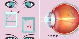 სავარჯიშოები თვალის კუნთების გასაძლიერებლად და მხედველობის გასაუმჯობესებლად